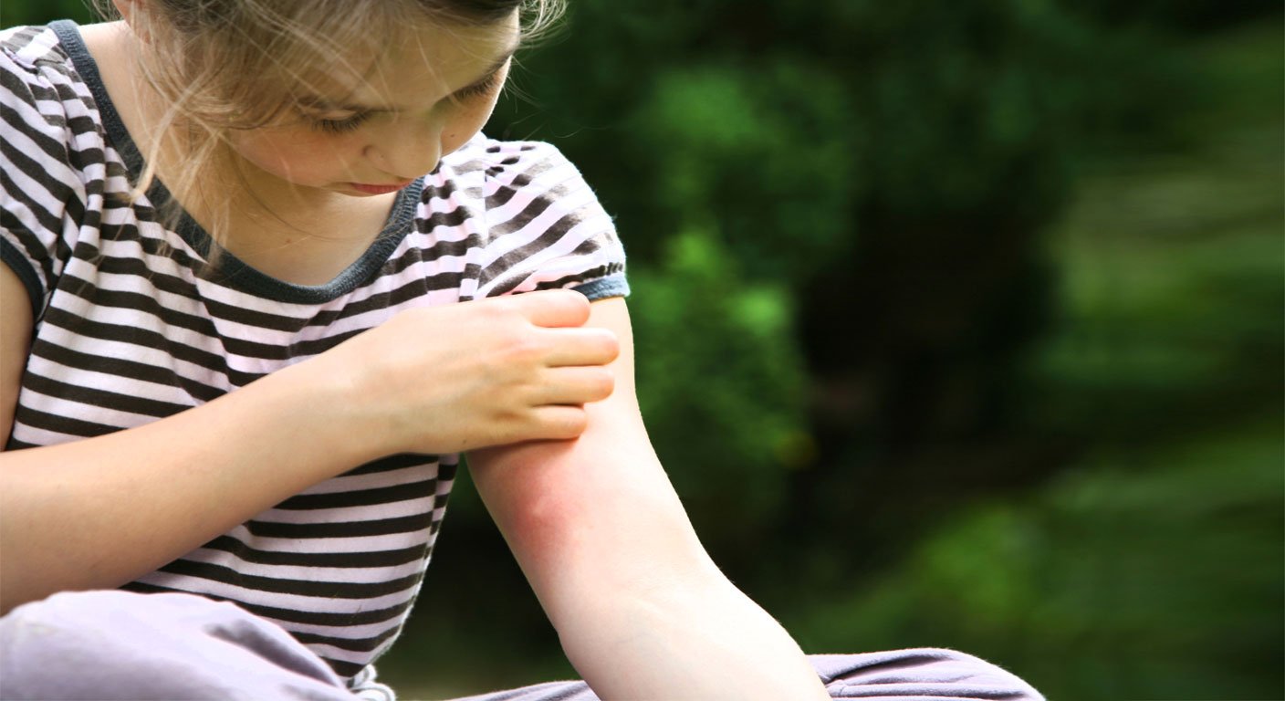 Why This Summer's Humidity Is Bringing Out More Mosquitoes